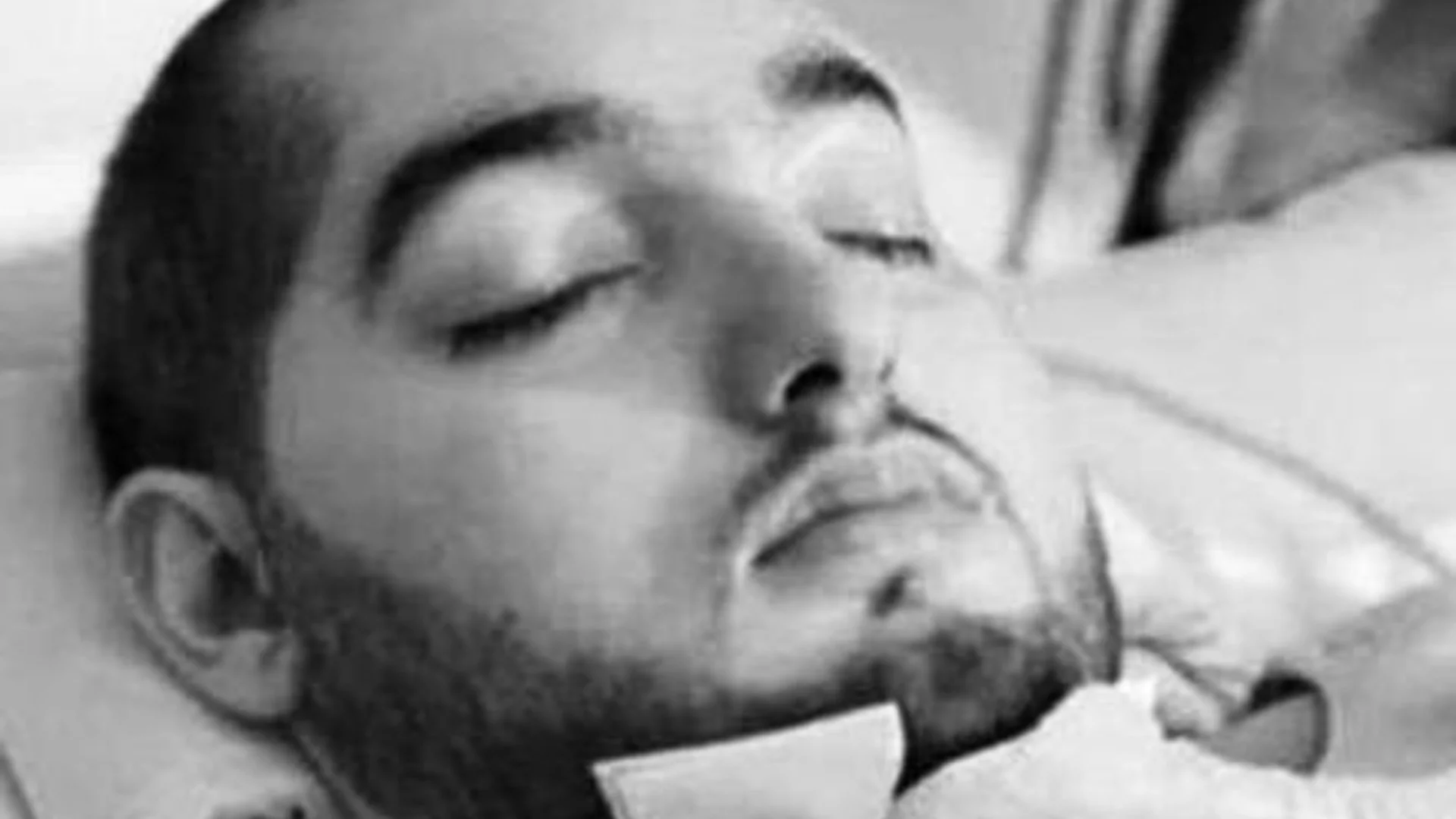 "Спящият принц", който прекара две десетилетия в кома, почина на 36 години