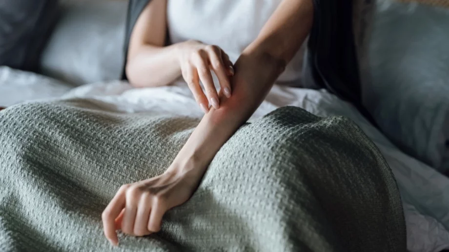 Екзема срещу псориазис: Как да разберем разликата