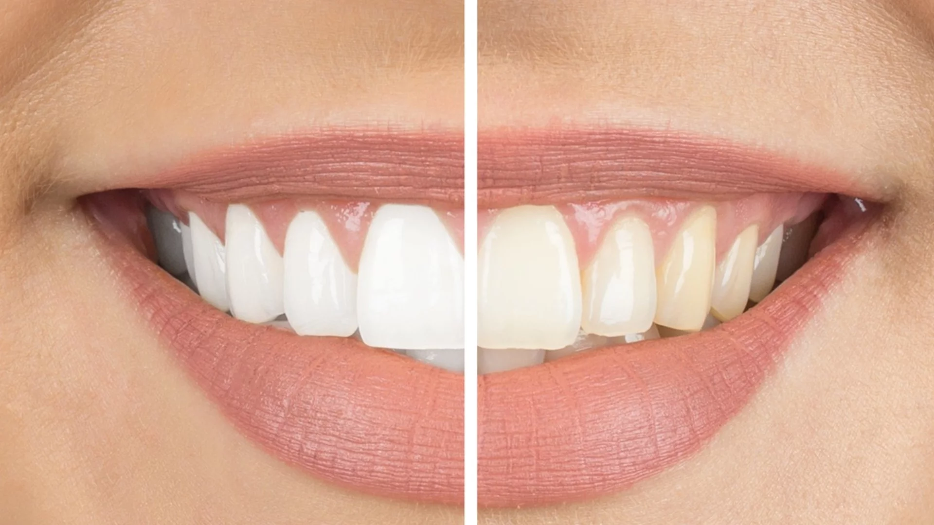 Може ли избелването да бъде щадящо?