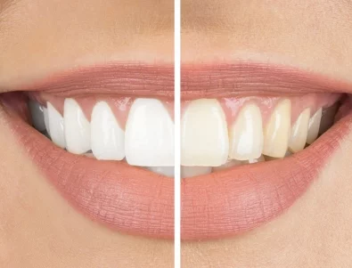 Може ли избелването да бъде щадящо?