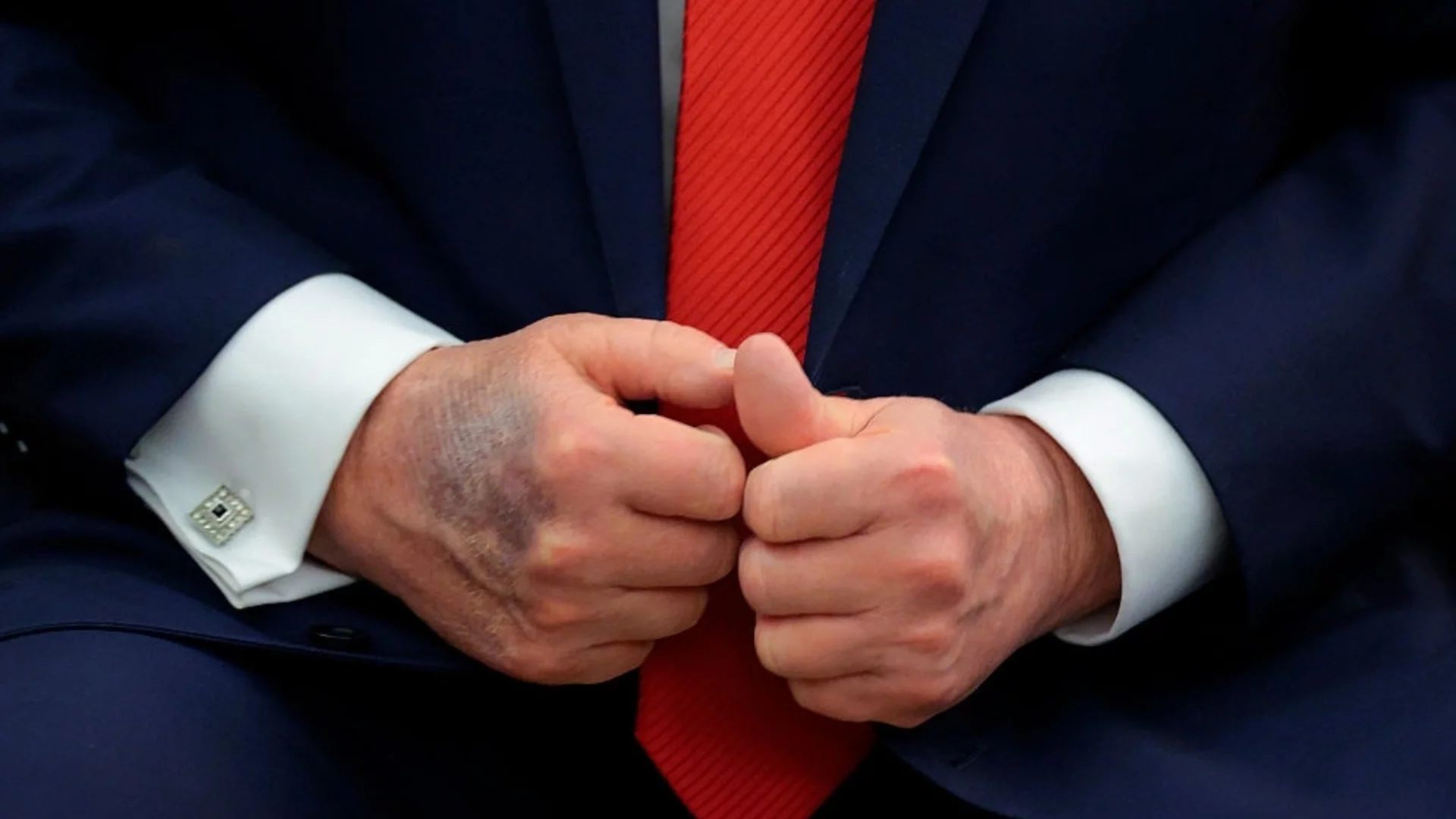 "Като кралица Елизабет преди да умре": СНИМКИ на ръцете на Тръмп пак разбуниха духовете (ВИДЕО)