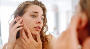 5 кожни пъпки, които може да сбъркате с акне