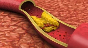 4 храни, които прочистват артериите и подобряват кръвообращението