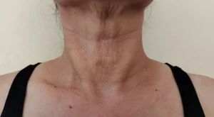 3 упражнения за стягане на отпуснатата кожа по шията