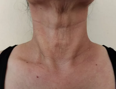 3 упражнения за стягане на отпуснатата кожа по шията