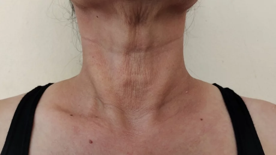 3 упражнения за стягане на отпуснатата кожа по шията