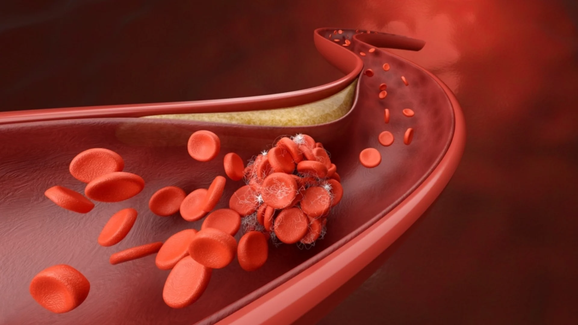 Природни средства за понижаване на нивата на холестерола