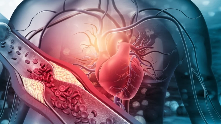 Здраве на сърцето: 4 начина да проверите за артериална плака у дома