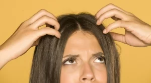 Как правилно да се грижите за сухия си скалп през зимата