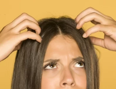 Как правилно да се грижите за сухия си скалп през зимата