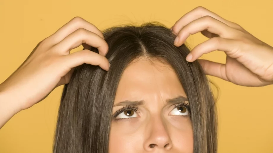 Как правилно да се грижите за сухия си скалп през зимата