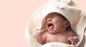 На фона на растящи случаи на морбили у нас: Тече антиваксърска кампания