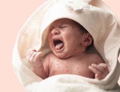 На фона на растящи случаи на морбили у нас: Тече антиваксърска кампания